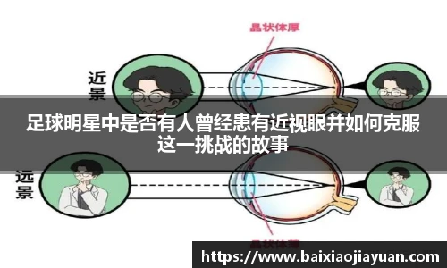 足球明星中是否有人曾经患有近视眼并如何克服这一挑战的故事